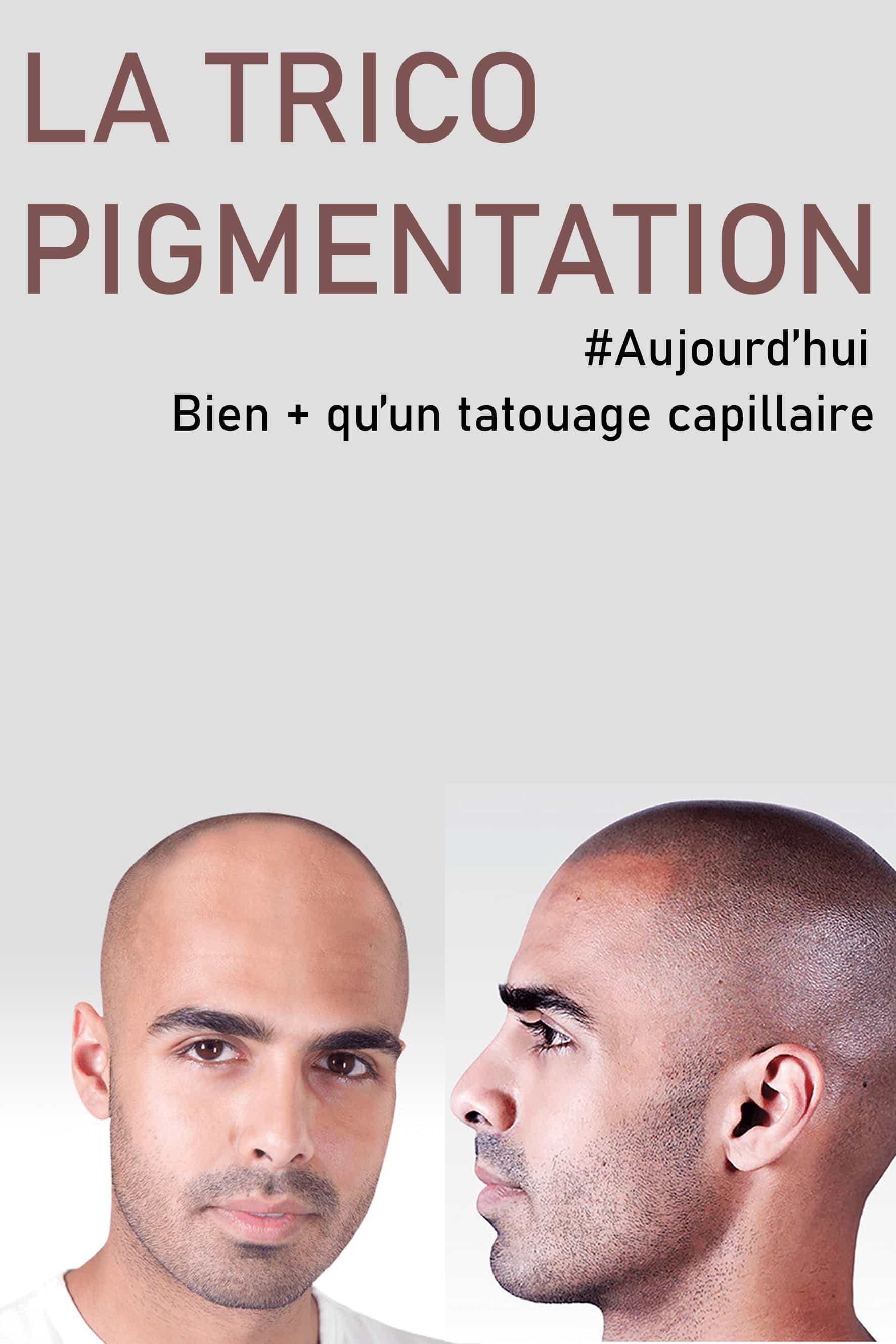 perruque homme indetectable
