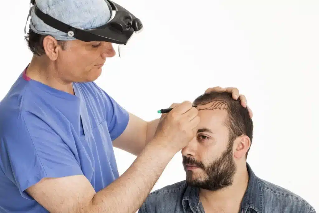 Consulter-cliniques-de-greffe-de-cheveux-choix
